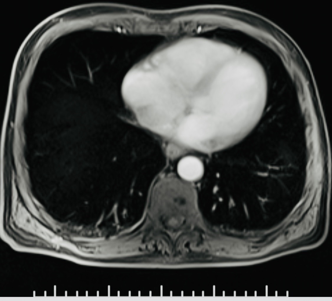 Cross-sectional imaging example used to illustrate neck/chest staging assessment